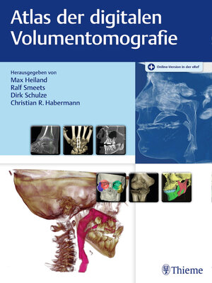 cover image of Atlas der digitalen Volumentomografie